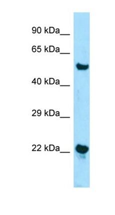 ZDHHC12 antibody
