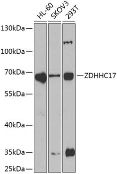 ZDHHC17 antibody