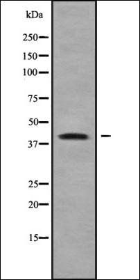 ZDHHC18 antibody