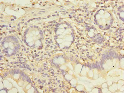 ZDHHC2 Antibody