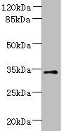 ZDHHC3 Antibody