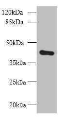 ZDHHC4 antibody