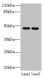 ZDHHC6 Antibody