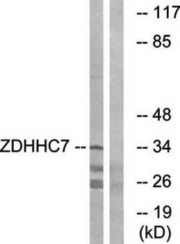 ZDHHC7 antibody