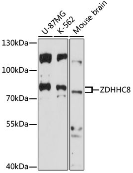 ZDHHC8 antibody
