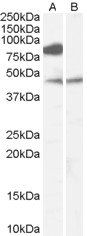 ZDHHC8 antibody