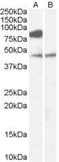 Goat anti-ZDHHC8 Antibody