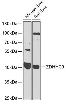 ZDHHC9 antibody