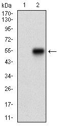 ZEB1 Antibody