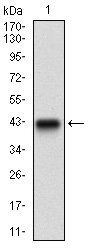 ZEB1 Antibody