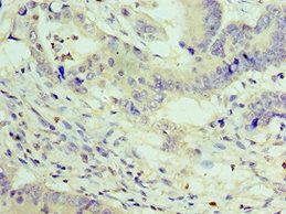 ZEB2 Antibody