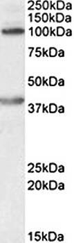 Goat anti-ZEB2 (aa545-558) Antibody