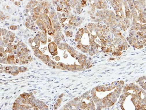 ZER1 Rabbit Polyclonal Antibody