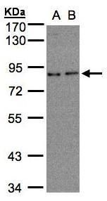 ZER1 Rabbit Polyclonal Antibody
