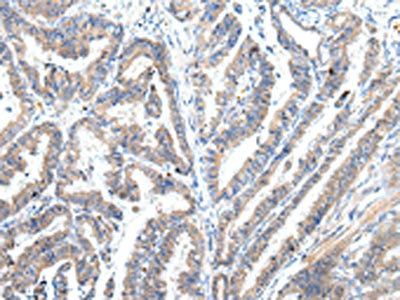 ZFAND2A Antibody