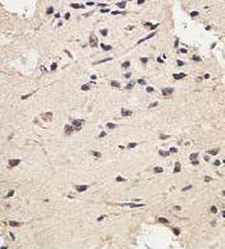 ZFAND2B Rabbit Polyclonal Antibody