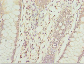 ZFAND3 Antibody