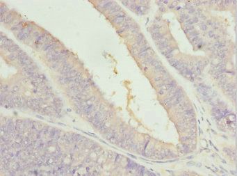 ZFAND3 Antibody