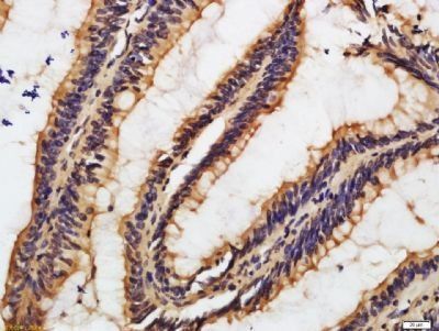 ZFAND5 Rabbit Polyclonal Antibody