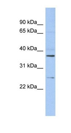 ZFAND6 antibody