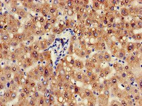 ZFAND6 Antibody