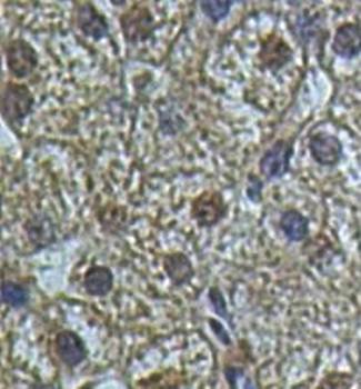 ZFP161 Rabbit Polyclonal Antibody