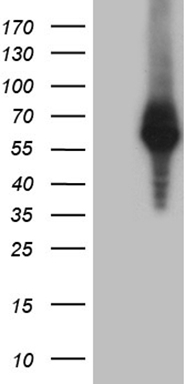 ZFP200 (ZNF200) antibody