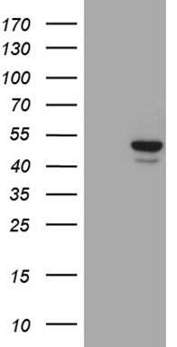 ZFP200 (ZNF200) antibody