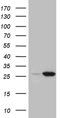 ZFP200 Antibody