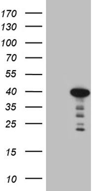 ZFP200 (ZNF200) antibody