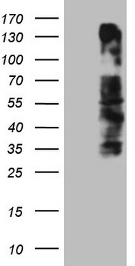 ZFP200 Antibody