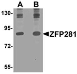 ZFP281 Antibody