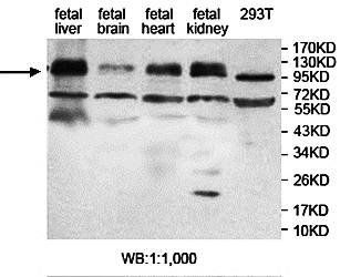 ZFP28 antibody