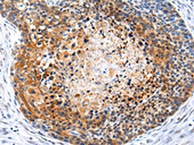 ZFP30 Antibody