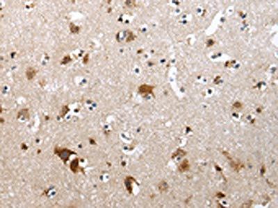 ZFP30 Antibody