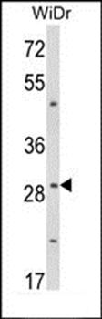 ZFP36 antibody