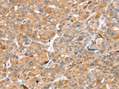 ZFP36L2 antibody