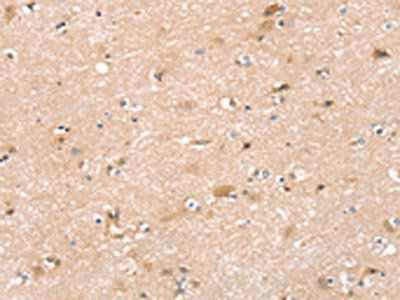 ZFP36L2 Antibody