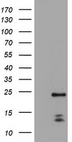 ZFP38 (ZSCAN21) antibody