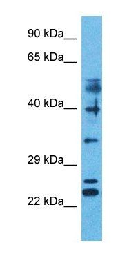 ZFP41 antibody