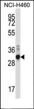 ZFPL1 antibody
