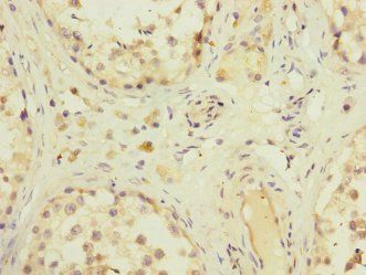 ZFPM2 Antibody