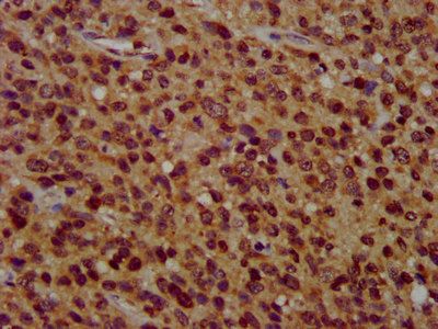 ZFX Antibody
