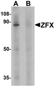 ZFX Antibody
