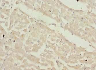 ZFYVE16 Antibody