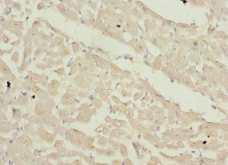 ZFYVE16 antibody