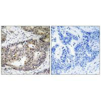 ZFYVE19 Antibody