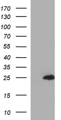 ZFYVE21 antibody
