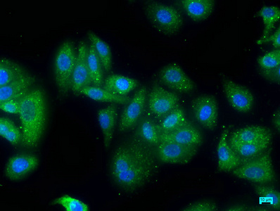 ZFYVE9 Antibody