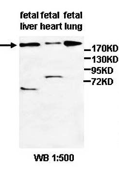 ZFYVE9 Rabbit Polyclonal Antibody